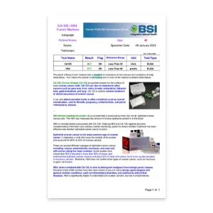 CA-125 / HE4 Tumor Markers