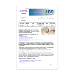 Vitamin A Blood Concentration